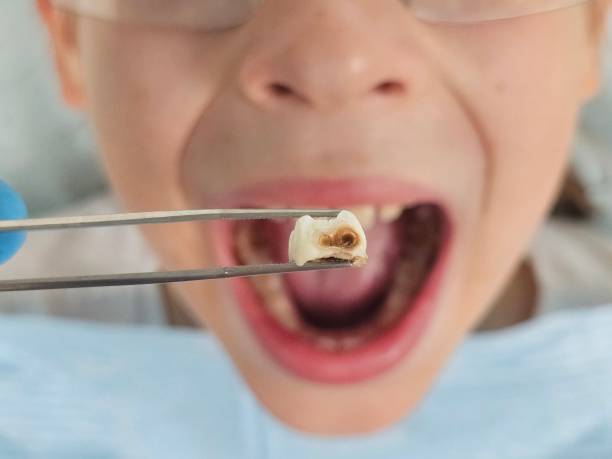 Best Affordable Emergency Dental Care  in Honey Grove, TX